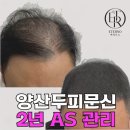 에테르노 | 양산두피문신 헬멧 벗을 때마다 신경 쓰였던 정수리, 에테르노 상담 후기