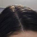 두피가 답답해서 써본 두피앰플 아썸앰플 후기