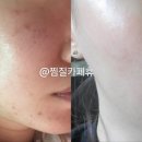 체온다이어트휴