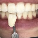 해맑은치과의원 이미지