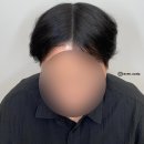 레이븐스칼프 이미지