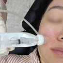 뉴송정자동차서비스 | 분당정자동피부과 쥬베룩스킨부스터 잘하는곳 리얼후기 (내돈내산)