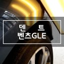 허덴트 이미지