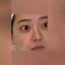 메디클립