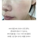 루나크의원 | 스킨바이브, 레티젠, 루톡스 - 스킨부스터 종류 효과 가격 비교