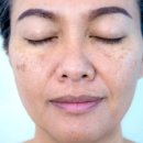 청담아이스피부과의원 이미지