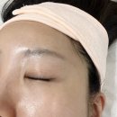 레몬슈가에서 여름나기 헤어라인 왁싱 후기