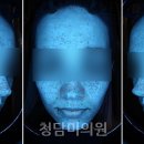 청담미의원 네이버블로그