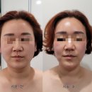 모블링왁싱 네이버블로그