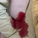 서울병원 | PSVT 부정맥 시술 이야기(삼성서울병원 입원 후기_순환기내과 발작성 상심실성 빈맥)