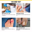 연세미초롬의원 네이버블로그
