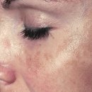 반가워,약국 이미지