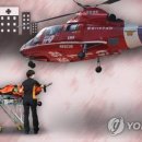 이송