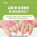 H 교정치과기공소 | 팔용동치과 치아교정 후 유지장치 얼마나 착용해야 되나요?