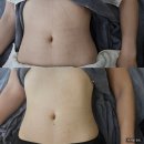 학익힐스공인중개사사무소 | 복부 하체 부종 없애주는 고주파 림프순환관리(난임테라피), '결앤핏' 찐후기