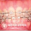 가락서울치과 이미지