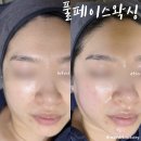 맨드리 | 울산 달동 워킹맘의 변신은 무죄! 언제나 늘 예쁜 워킹맘의 풀페이스왁싱 후기