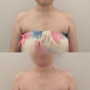 [강남/논현] 뷰티다룸 강남본점 | 승모근 여리핏·직각어깨 관리 후기 | 1회만에 라인이 달라졌다