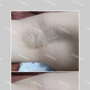 롬프란 스킨앤바디 이미지