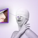 들창코 이미지