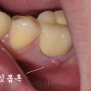 더바른윤치과의원 네이버블로그