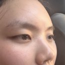 화원화장품 | COCI X 화원 시카 토너 · 패드 · 앰플 이마 여드름 모낭염 올라오는 사람 솔직 후기