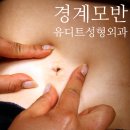 유디트의원 | 경계 모반 (Junctional Nevus) 배꼽 점 제거 수술 후기 : 수원 광교 성형외과