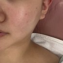수원-0658 | 수원역 피부관리 잘하는 곳 연예인필링 물톡스 받고온 후기 ::진뷰티