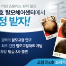 남자 여자 M자 탈모 눈여겨보는 두피 치료 관리 교정술 이미지