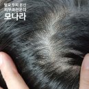 피부과 전문의 가마 탈모 두피 문신 가격, 회차