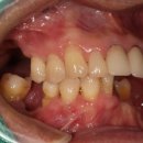 아이두치과기공소 이미지