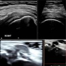 Re: Musculoskeletal ultrasound: a technical and historical perspective 2023 이미지