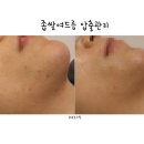 코코로스킨