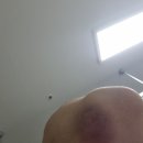 교통사고 후기
