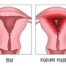 일신조산원 | 까먹을까봐 쓰는 내 자궁 상태