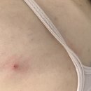 (주)드림바디 | 등드름바디워시 쿤달 아크네바디워시 바디미스트추천