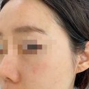 민성 메디칼 | 피부과추천 고보습재생크림 셀투덤 아쿠아 모이스처 사용후기