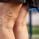 꼬불꼬불1,5,3 이미지