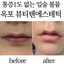 프리네일뷰티 | 반영구잘하는 곳 얇은 입술 고민 끝! 거제 옥포 '뷰티텐' 니들프리립플럼핑 후기
