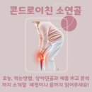 콘드로이친 소연골 성분의 효능 먹는방법 제품 비교 분석