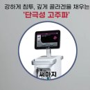 SM블레싱 | 리프팅 효과, 부작용, 다운타임, 가격, 비용, 후기(얼굴 리프팅 추천, 팔자주름, 잔주름, 피부 탄력) by...