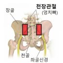 에스스트레칭 이미지