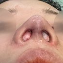 노즈랩의원 이미지