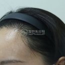 펌&컷헤어라인