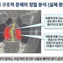 코숨샘물한의원 | 원인을 알 수 없는 두통과 비염