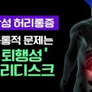 100세 시대, 허리가 관건! 만성 허리통증 환자들의 공통적인 문제는 바로 '퇴행성 허리디스크' 이미지