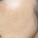 좋은날피부과의원 이미지