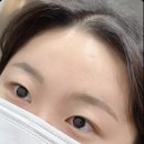 비비네