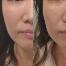 라라뷰티샵 | 쌍문역에스테틱 라라뷰티샵에서 스킨플래닝 에끌라뒤땅 머미관리 후기