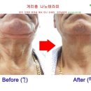 퀸 피부샵